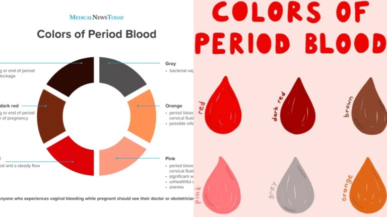 Womens health: What does the color of your period mean